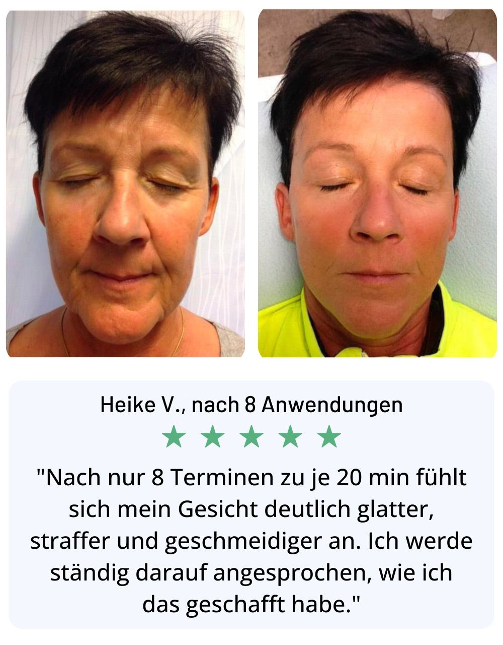 Radiofrequenz Behandlung Gesicht