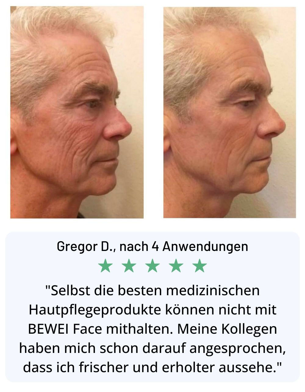 Hautbehandlung Technologie